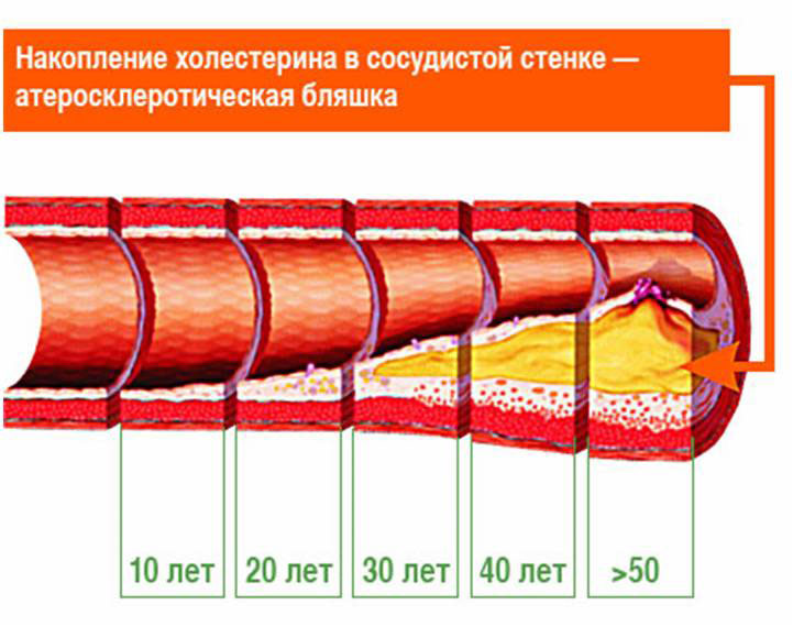 Болезни по причине употребления мяса